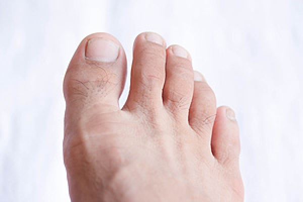 Pinky Toe Pains: Causes and Treatments